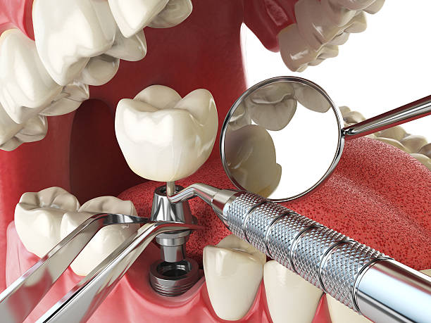 Best Orthodontic Emergency Dentist in Rupert, WV